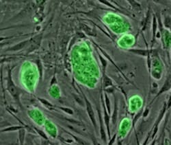 stem_cells