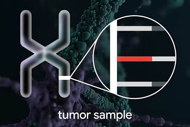 tumor sample