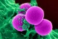 human neutrophil ingesting MRSA